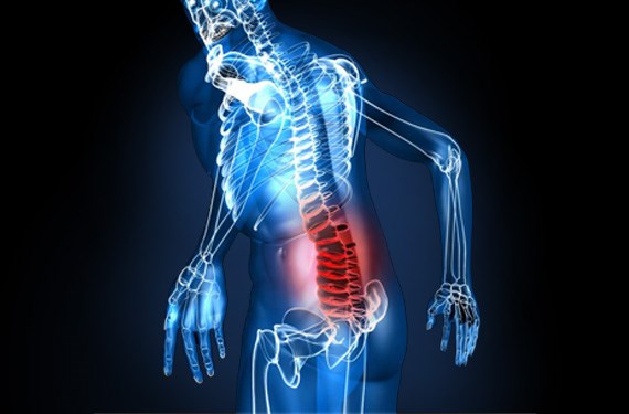 What Is A Work Related Muscular Skeletal Disorder (wmsd)?